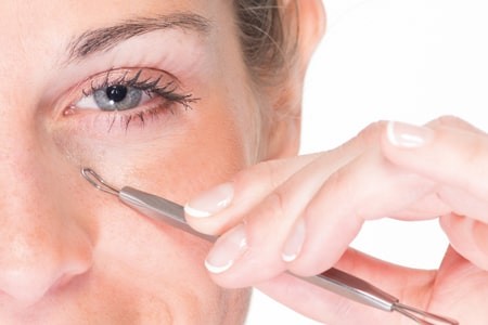 comedone extractors stainless, 10 cm comedone extractors stainless, 10 cm